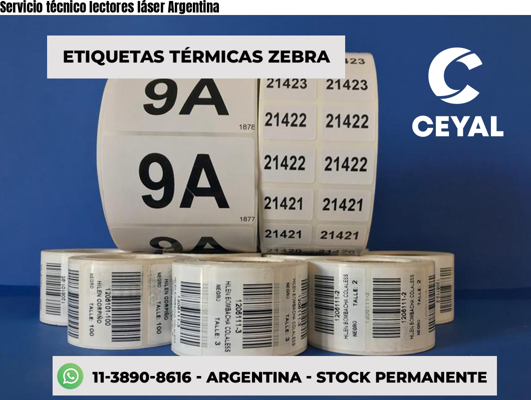 Servicio técnico lectores láser Argentina